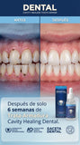 DENTAL – Cavity Healing Tooth Armor Sérum _ dental en gotas | 60ml G